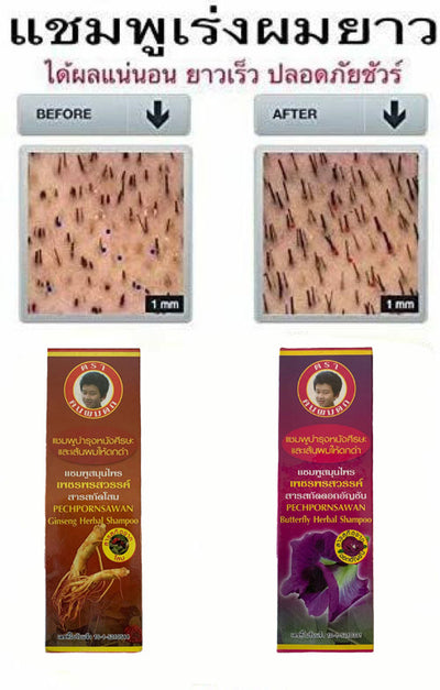 Anti Hair Loss Pechpornsawan Shampoo 240ml Herbal Hair Root (Pack of 3)