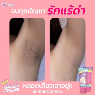 Gangnam-Clinic-Underarm-Cream-whitening