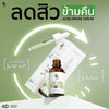 Time Release Control - Gradual Acne Dissolution