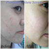 Enhanced radiance and glow from using Provamed Gluta Complex Bio Serum