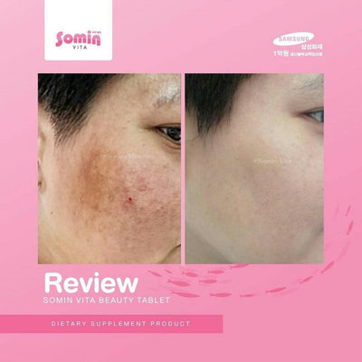 Reveal Youthful Skin with Somin Vita