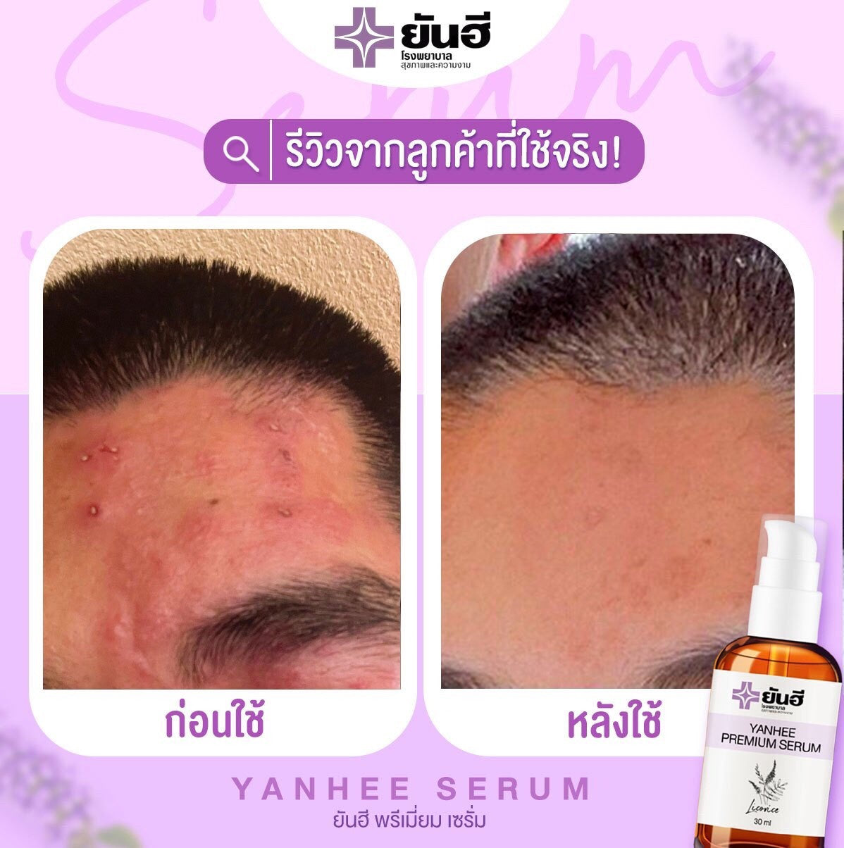 yanhee premium serum - Thaimegastore