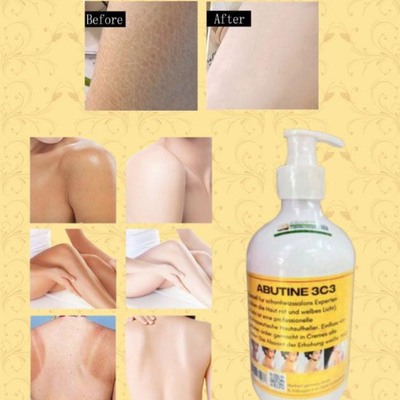 ABUTINE 3C3 skin care product with 'Before' and 'After' skin comparison on a yellow patterned background