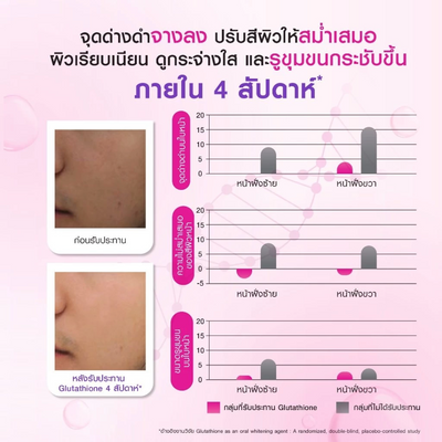 Supplement for skin luminosity Bomi R-Gluta X