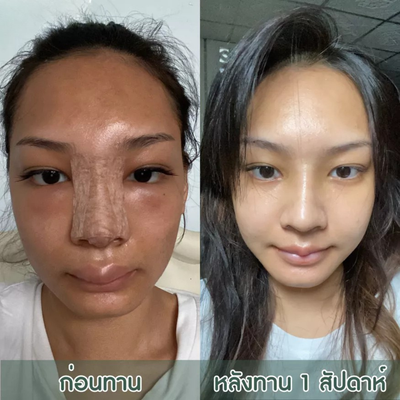 Centa Centica Thailand supplement
