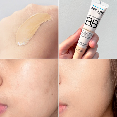 Results before and after of Clear Nose Acne Care Solution BB SPF50 PA+++