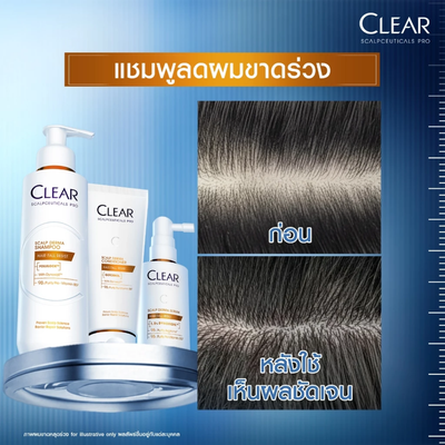 Image showing the results before and after of Clear Saclpceuticals Pro Scalp Derma Hair Fall Resist Full Set