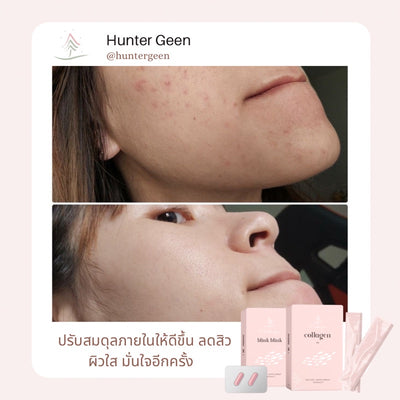 Antioxidant Support and Skin Renewal with Hunter Geen Collagen