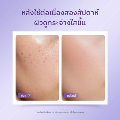Dark spot serum with Roots Blend Extract