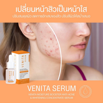 Oil Control Acne Serum