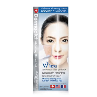 Melasma and dark spot whitening cream