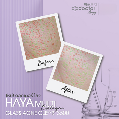 Doctorlogy Haya Multi Collagen results before and after