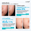 Moisturizer suitable for sensitive skin
