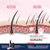 Dr.PONG Tsutsuji Scalp Treatment Spray