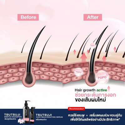 Dr.PONG Tsutsuji Scalp Treatment Spray