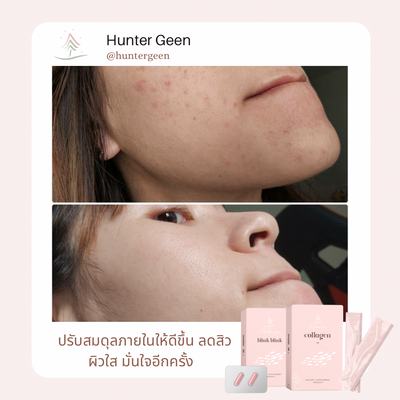 Reveal Your Beauty with HUNTER GEEN Blink Blink: Clear Skin and Aura