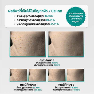 Korean PORECENT pore minimizing serum