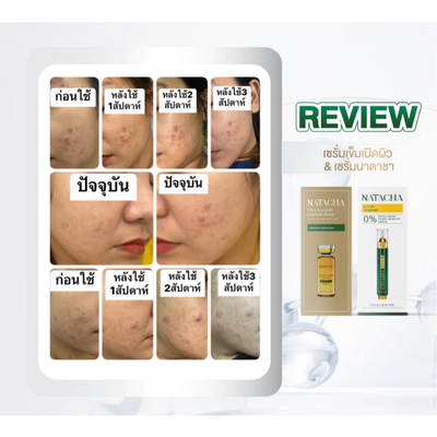 Natacha serum containing tranexamic acid
