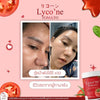 Reduce dark spots with Lycone Tomato Dietary Supplement