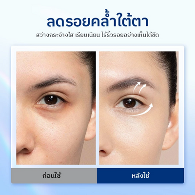 The Originote serum for under-eye puffiness