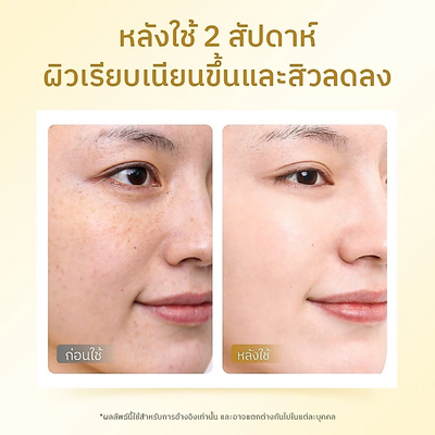 The Originote Niacinamide brightening face serum