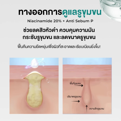 PORECENT serum for visible enlarged pores