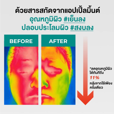 PORECENT Tightening Solution for oily skin