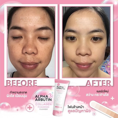 Precious Skin alpha arbutin cleanser