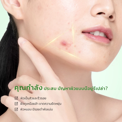 Close-up of a person pointing to acne on their face with a green background