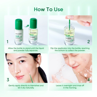 Instructions on how to use SKINTIFIC Acne Drying Lotion with images of the product and application steps.
