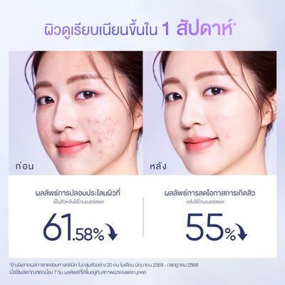Skintific facial pads with niacinamide and acids