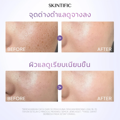 Hydrating dark spot serum with Niacinamide