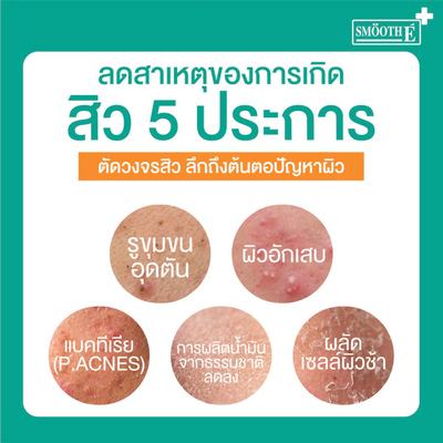 Smooth E Lightweight Acne Serum