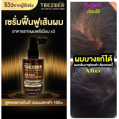 Before and after results of Teezeer hair serum