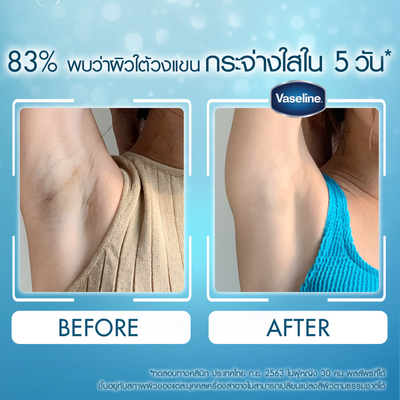 Clinically proven Vaseline Underarm Brightening Serum