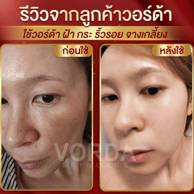 Korean Ginseng Extract for wrinkle reduction