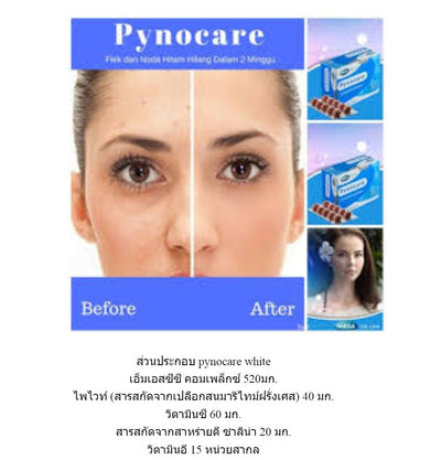 PYNOCARE WHITE 20 Soft-gels