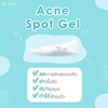 Pimple treatment gel for a blemish-free face