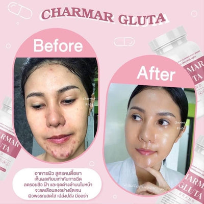 Charmar Gluta daily beauty supplement