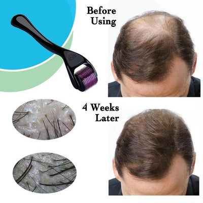 Professional Grade Titanium Derma Roller 1mm