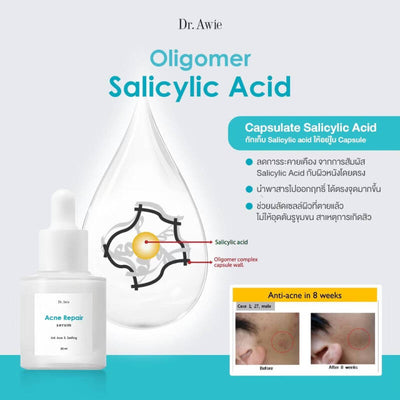 Biosaccharide Gum-I & Gum-II for Inflammation Reduction in Dr. Awie Acne Serum