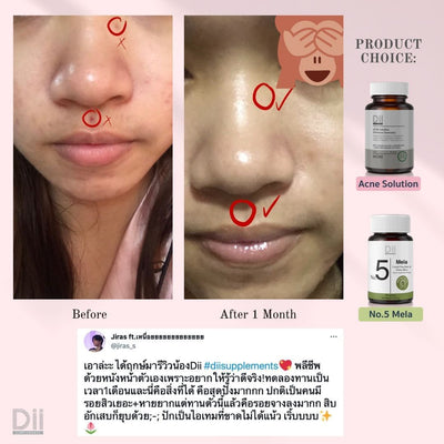 Skin pigmentation support supplement
