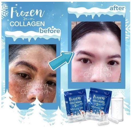 Frozen Collagen 2 in 1 whitening x10 - L Glutathione 10,000mg