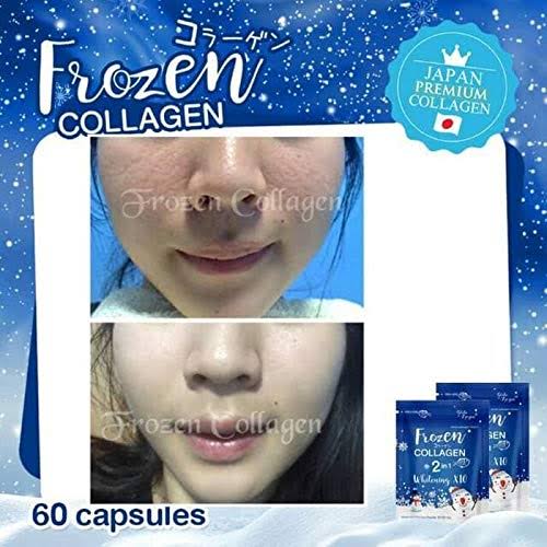 frozen collagen glutathione 12X Frozen Collagen 2 in 1 whitening x10 - L Glutathione
