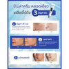Melasma and pigmentation treatment cream