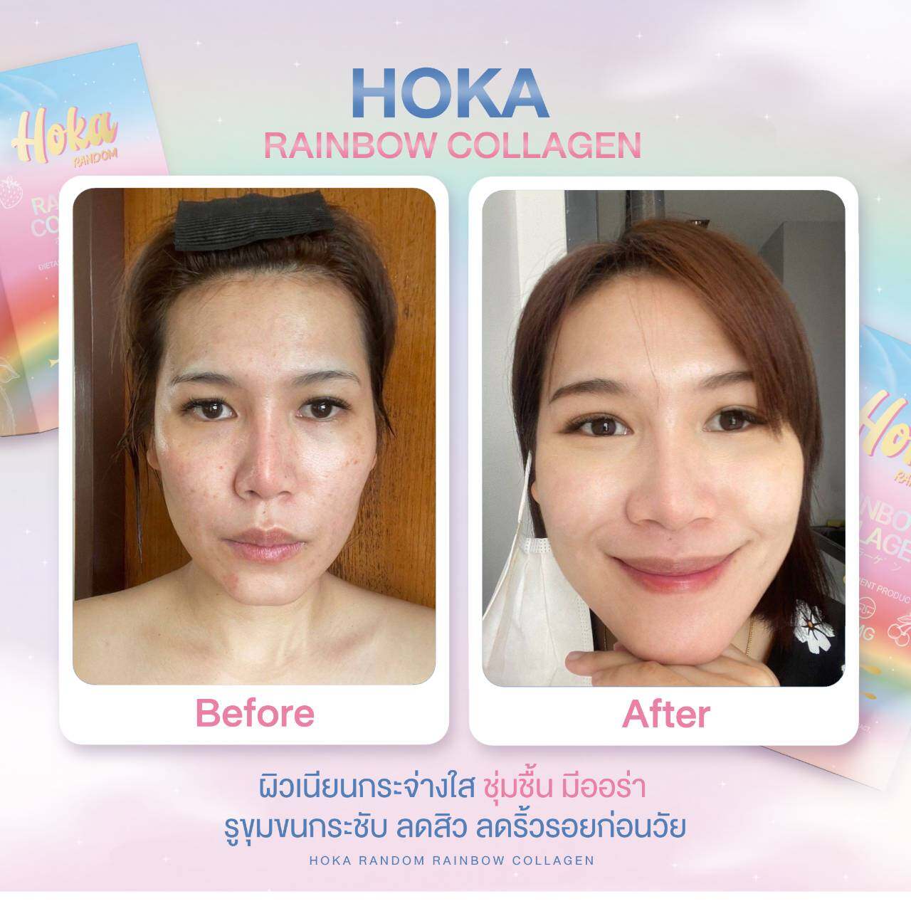 Hoka rainbow collagen showing before and after results