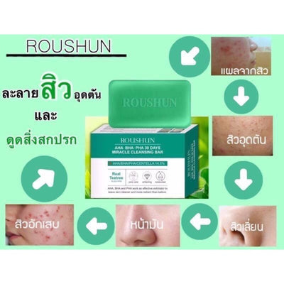 Pore tightening skincare bundle