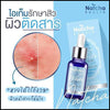 Serum to fade acne scars and redness