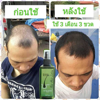 Herbal hair care tonic from Thailand