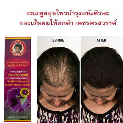 Anti hair fall shampoo 240ml x 3 bottles